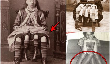 La fascinante vida de Josephene Myrtle Corbin: la extraordinaria mujer de cuatro patas con dos sistemas reproductivos